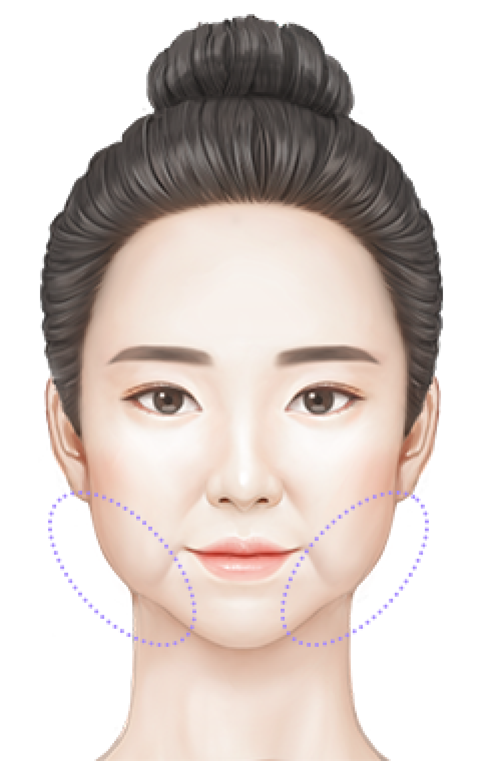 처진 볼살 부위 표시